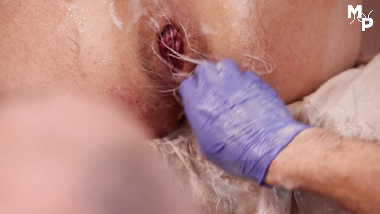 Marcus Pollack Gay: 被打进男人的洞里