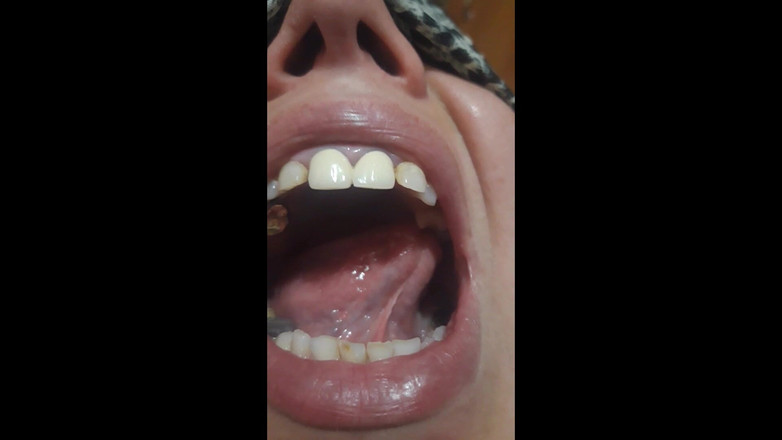 Paultramp: Parmak ısırması