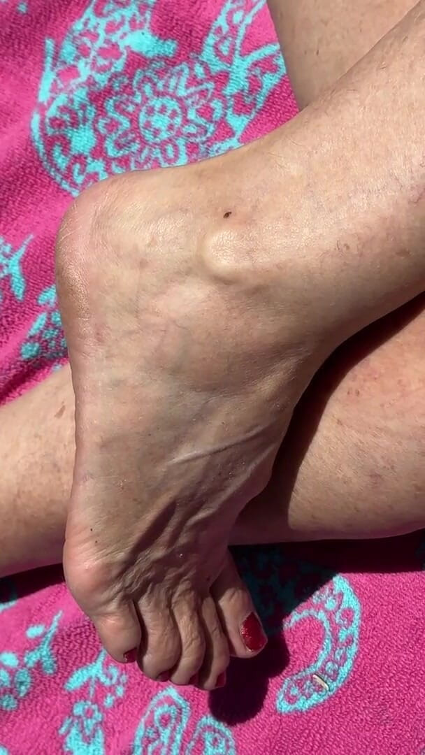 Aunt Ann: Fan Request Granny Naked in Sun Shows Dirty Rough Soles &amp;...