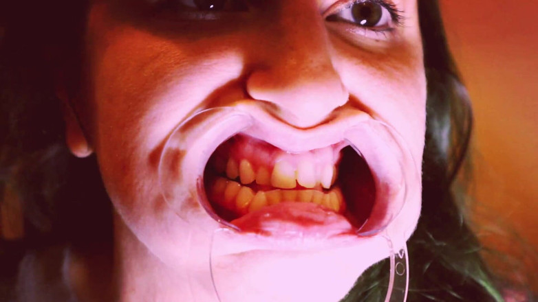 goddessjoules: Preparing for Invisible Aligners