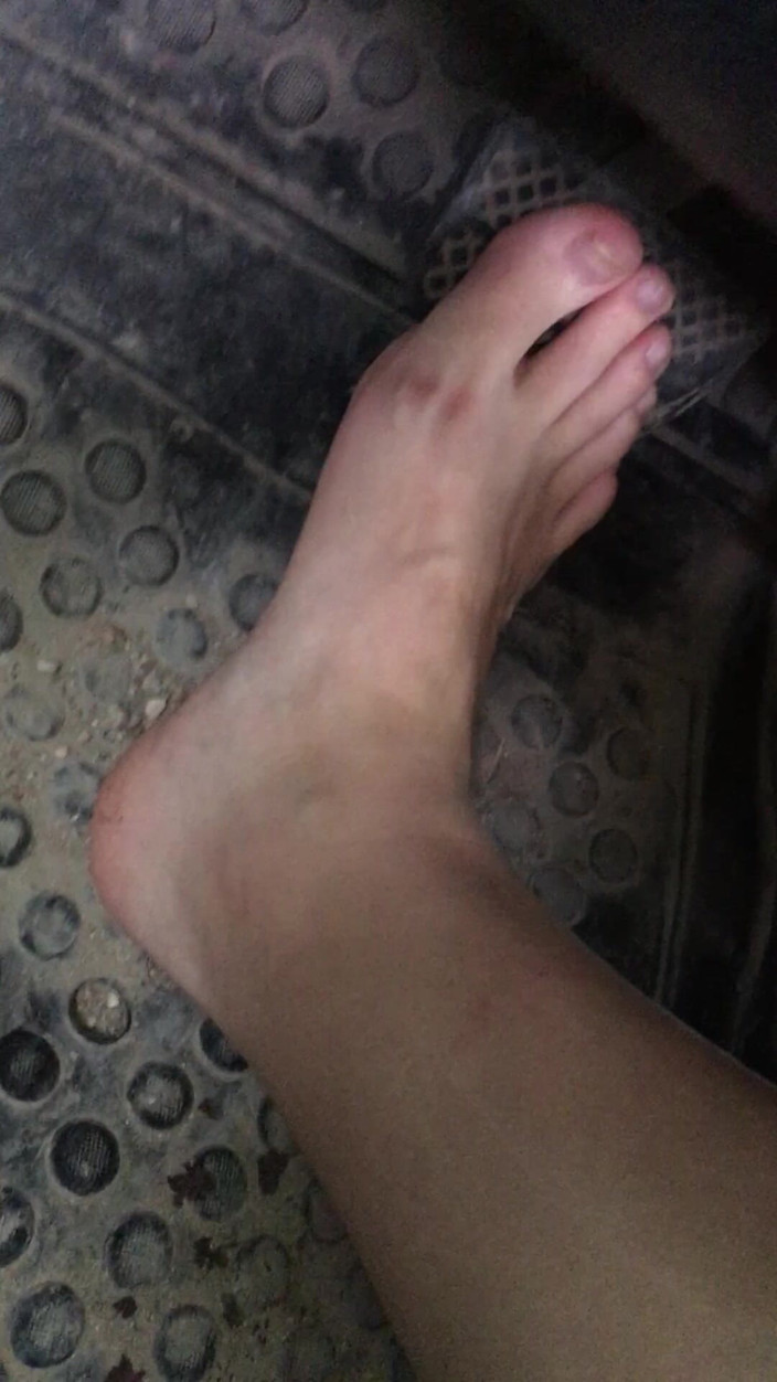 Risky Hairy Couple: I Press the Gas and Brake Pedals in Car