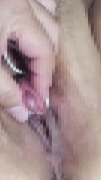 I Restrict the Clitoris That the M Woman Was Enlarged with a Thread and Let You Do the Consecutive Top