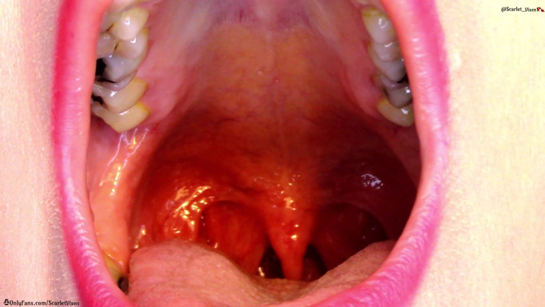 Scarlet Vixen: Throat, Uvula &amp; Mouth Showoff