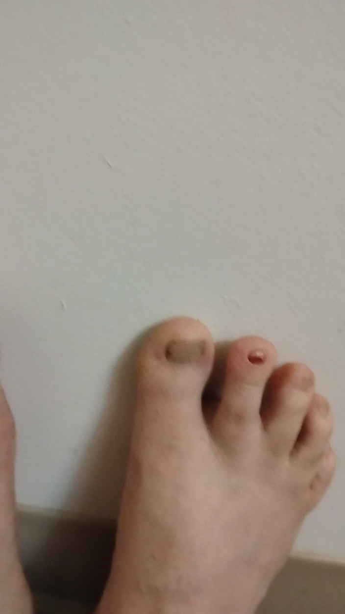 JG Risk: 11-26-2025 Schattige kleine tenen