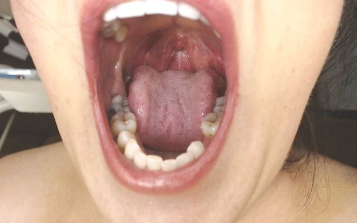 Abby Anna: Hrdlo a ústa Plivá řetězce Uvula Tonsils Uvula