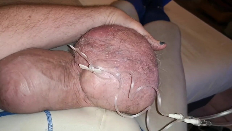 Monster_Meat_: Tampalan berganda glukosa 2liter