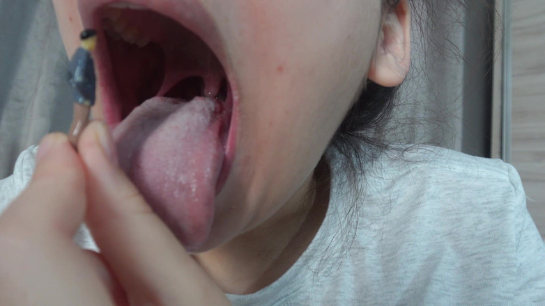 AmayaMori: Sora mea vitregă uriașă se joacă de-a dentistul cu fratele...