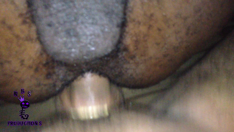 NB Topper: 黑色冒险 57