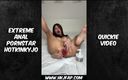 Hotkinkyjo: 15.april.2024 &amp;quot;quickie video&amp;quot; fisting, fisting anal, analfista, prolapso, prolapso anal, anal,...