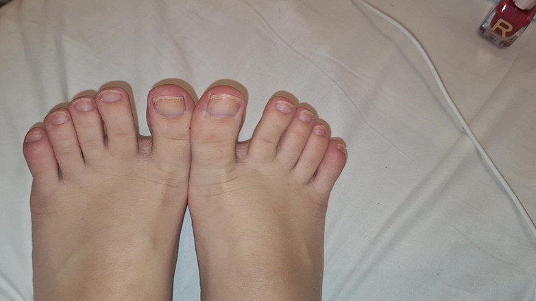 Mell: Dlouho potřebná polské čištění