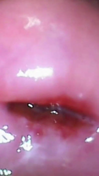Extreme close-up poesjescamera