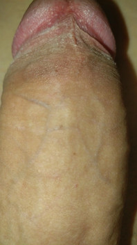 Faceți cunoștință cu băiatul meu epuizat