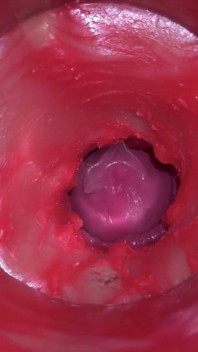Camera Inside Pussy - Powerfull Cum in Pussy! Best Internal Asmr
