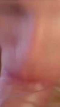 Both Holes Are Plugged
