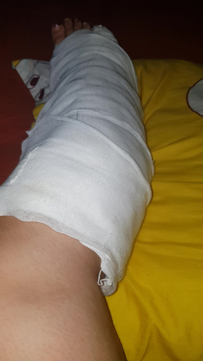 LoraBbw: Lắc lư các chân của tôi trong diễn viên