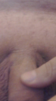 Zoppicare il cazzo