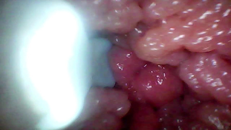 Ladybottox: Endoscope Camera Records My Wife's G Spot. Educational Video Close...
