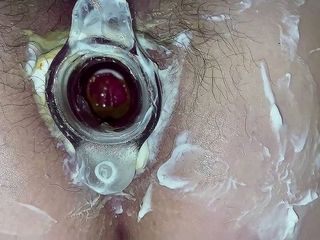 Anal stepmom Mary Di: Hot Anal gaping &amp; tunnel plug. Hairy cunt &amp; asshole close-up