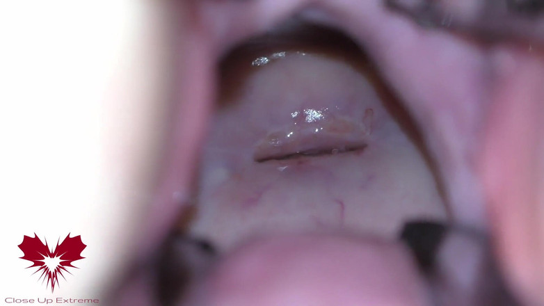 Close Up Extreme: 女主人的阴户用扩张器打开，以便你可以研究她的子宫颈