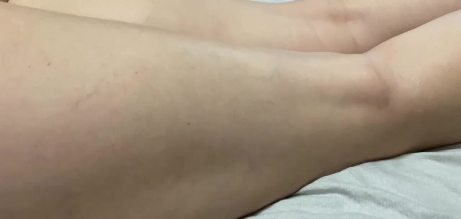 Supernasty: My leg like bed boys