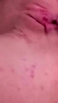 Extreme Anal Rosebud Prolapse - Dripping and Clenching Wildly