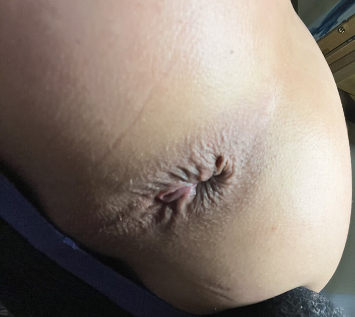 Stacey Loves Anal xxx: Staceylovesanal muncrat sendirian di pantat