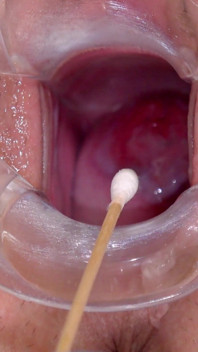 Silicone Sex Bomb Gets Treatment for Her Irritated Cervix