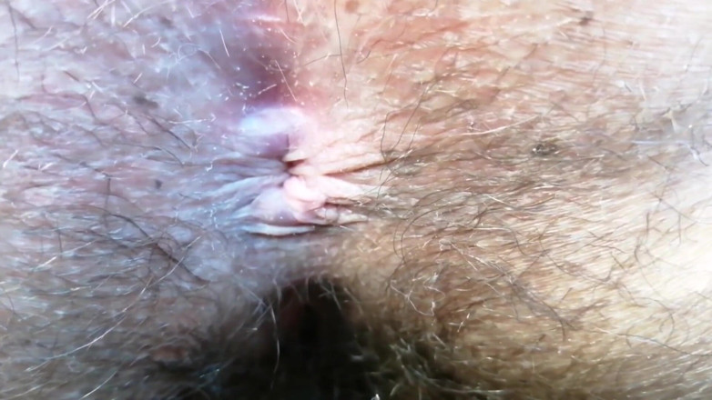 The Antichristrix: Kontgat close-up compilatie