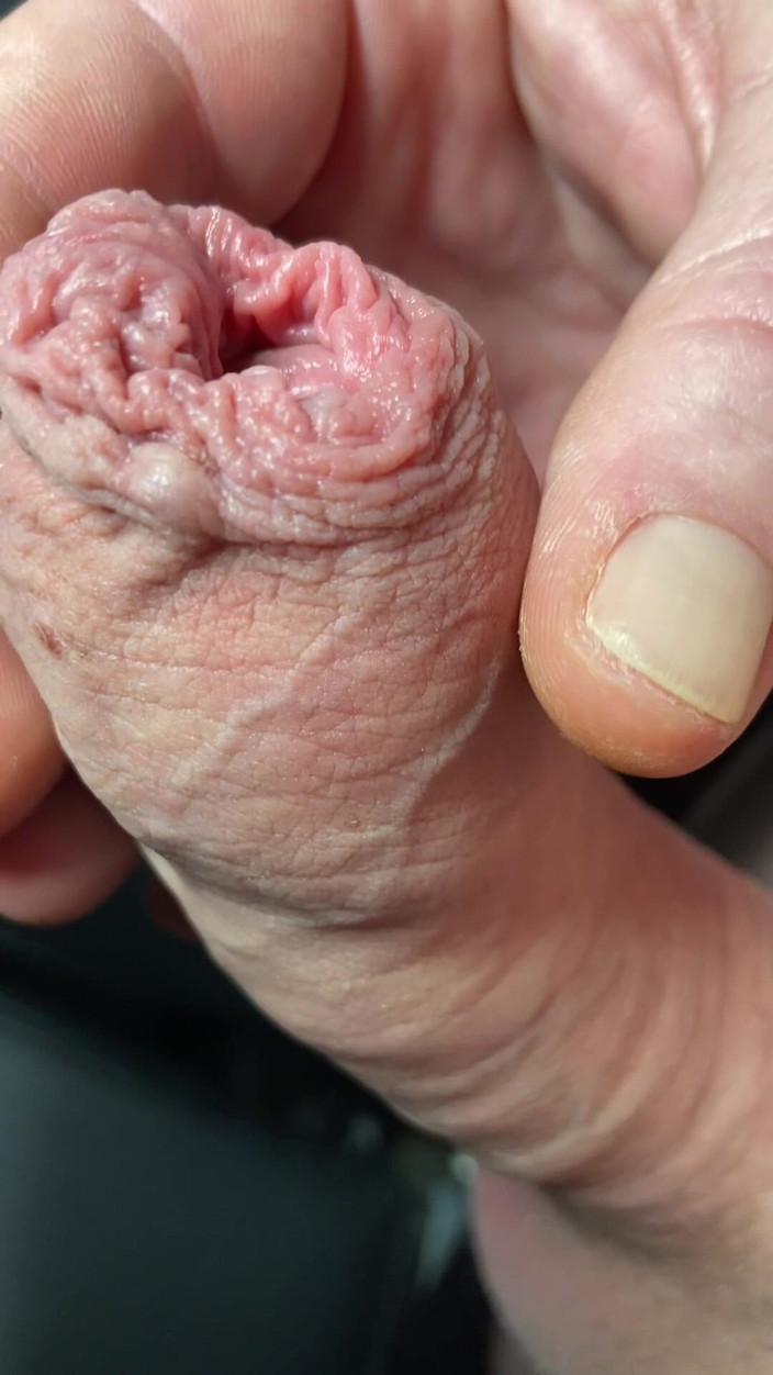 Foreskinguy: 대박 젖탱이의 포피와 자지 저코프