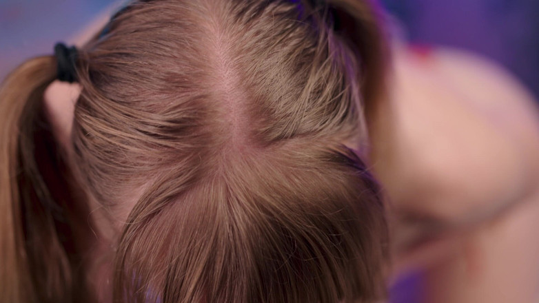 Jolie Lyon: Eigenaar worden van de parkslet