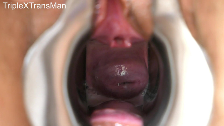 TripleXTransMan: 내 자궁 경부를 관통!
