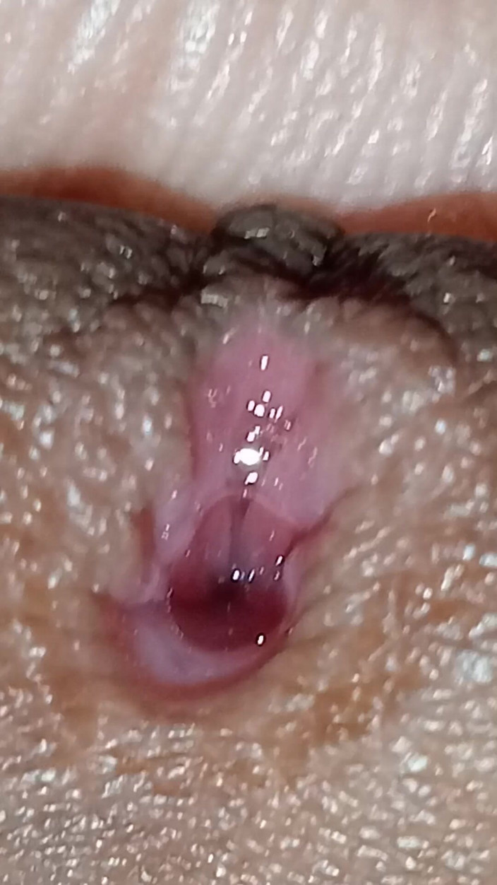 Mampi das: Celé otevřené video