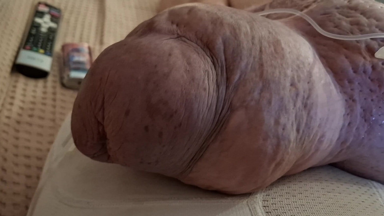 Monster_Meat_: Duże plomby Duże kule